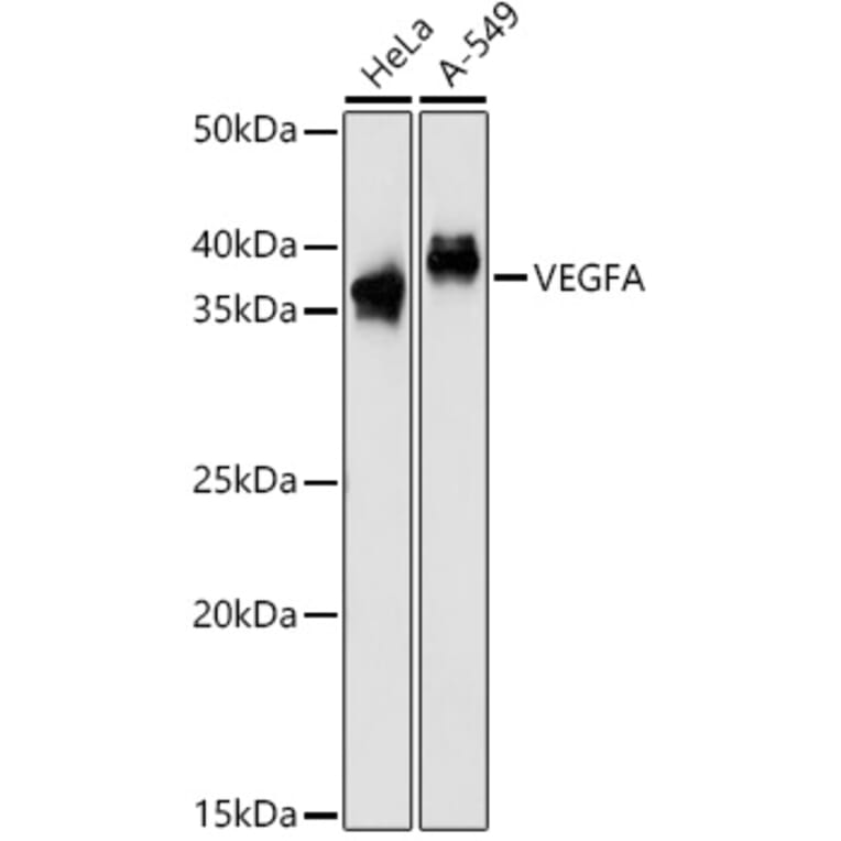 Western Blot - Anti-VEGFA Antibody (A90008) - Antibodies.com