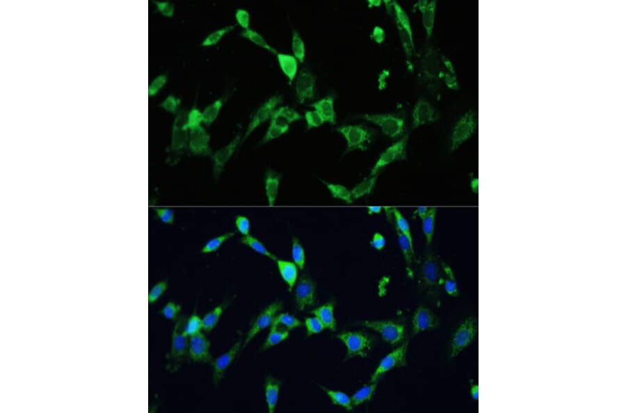 Immunofluorescence - Anti-VEGFA Antibody (A90008) - Antibodies.com