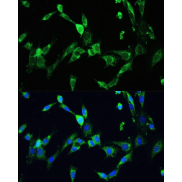 Immunofluorescence - Anti-VEGFA Antibody (A90008) - Antibodies.com