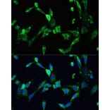 Immunofluorescence - Anti-VEGFA Antibody (A90008) - Antibodies.com