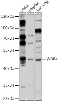 Western blot analysis of extracts of various cell lines, using Anti-WDR4 Antibody (A16487) at 1:1,000 dilution.
Secondary antibody: Goat Anti-Rabbit IgG (H+L) (HRP) (AS014) at 1:10,000 dilution.
Lysates / proteins: 25µg per lane.
Blocking buffer: 3% non-fat dry milk in TBST.
Detection: ECL Basic Kit (RM00020).
Exposure time: 60s.