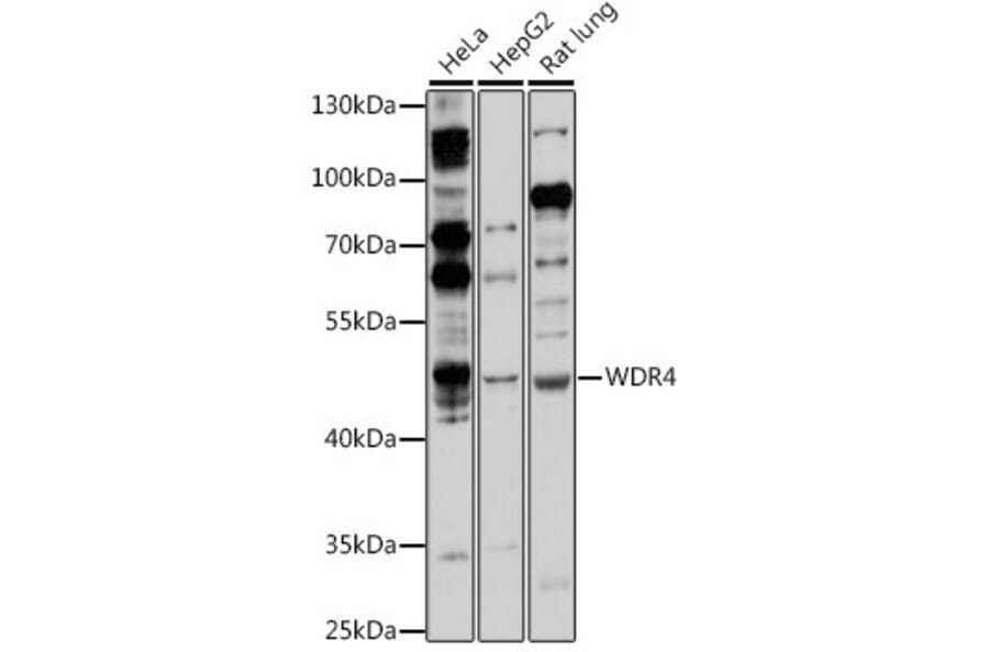 Western Blot - Anti-WDR4 Antibody (A90009) - Antibodies.com