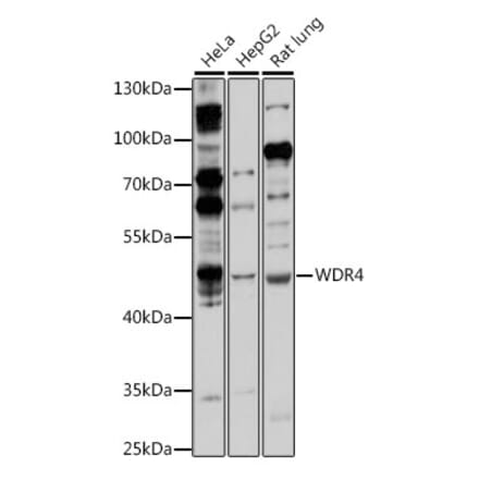 Western Blot - Anti-WDR4 Antibody (A90009) - Antibodies.com