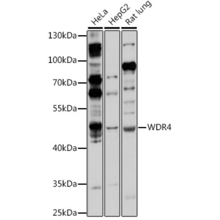 Western Blot - Anti-WDR4 Antibody (A90009) - Antibodies.com