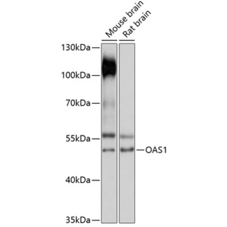 Western Blot - Anti-OAS1 Antibody (A90010) - Antibodies.com