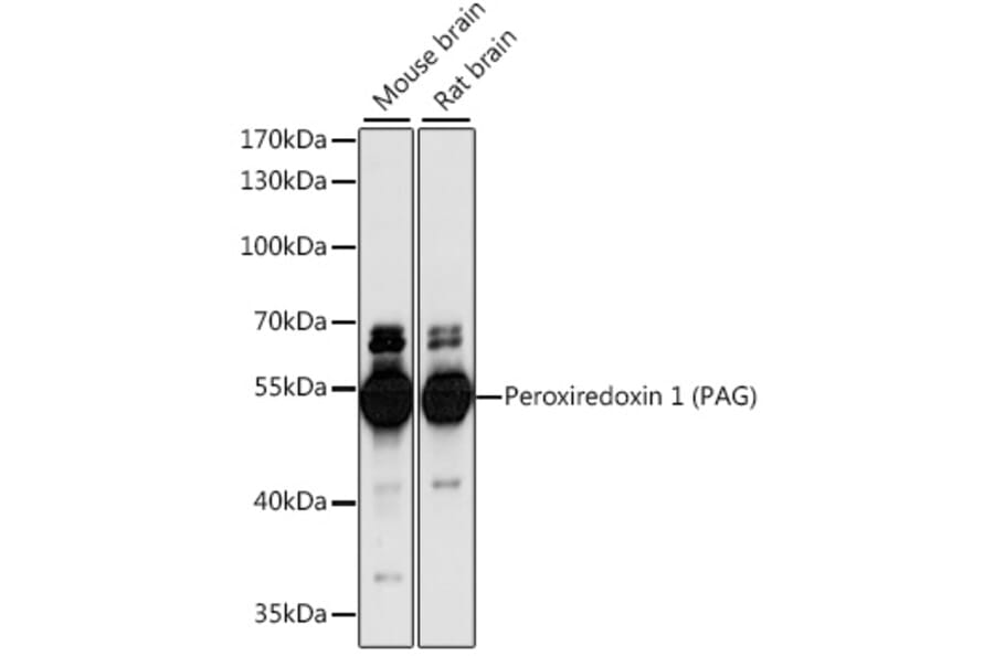 Western Blot - Anti-PAG Antibody (A90011) - Antibodies.com
