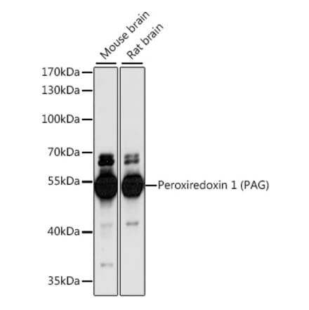 Western Blot - Anti-PAG Antibody (A90011) - Antibodies.com