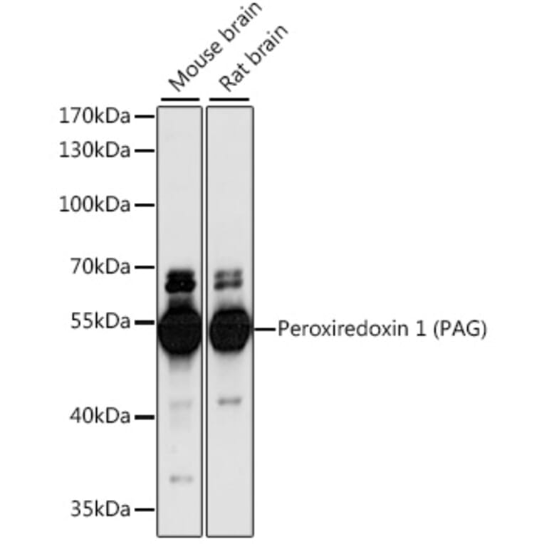 Western Blot - Anti-PAG Antibody (A90011) - Antibodies.com