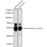 Western Blot - Anti-PAG Antibody (A90011) - Antibodies.com
