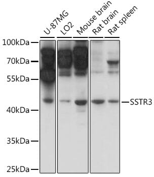 Western blot analysis of extracts of various cell lines, using Anti-SSTR3 Antibody (A16071) at 1:1,000 dilution.
Secondary antibody: Goat Anti-Rabbit IgG (H+L) (HRP) (AS014) at 1:10,000 dilution.
Lysates / proteins: 25µg per lane.
Blocking buffer: 3% non-fat dry milk in TBST.
Detection: ECL Basic Kit (RM00020).
Exposure time: 1s.