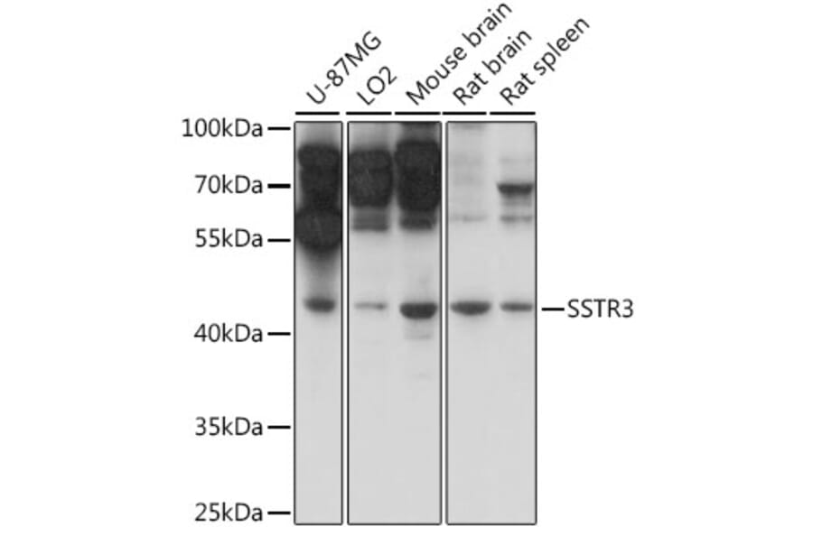 Western Blot - Anti-Somatostatin Receptor 3/SSTR3 Antibody (A90012) - Antibodies.com