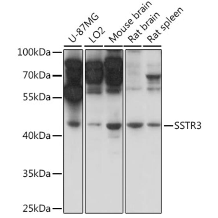 Western Blot - Anti-Somatostatin Receptor 3/SSTR3 Antibody (A90012) - Antibodies.com