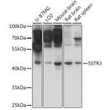 Western Blot - Anti-Somatostatin Receptor 3/SSTR3 Antibody (A90012) - Antibodies.com