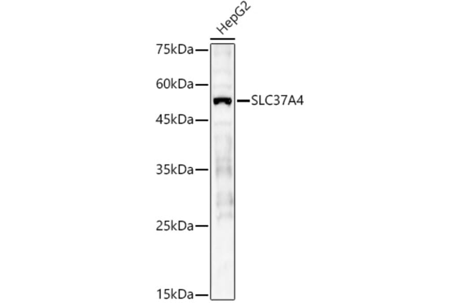 Western Blot - Anti-SLC37A4 Antibody (A90013) - Antibodies.com