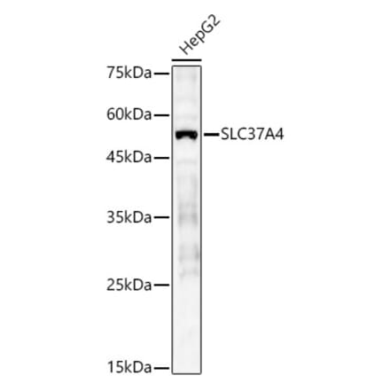 Western Blot - Anti-SLC37A4 Antibody (A90013) - Antibodies.com