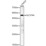 Western Blot - Anti-SLC37A4 Antibody (A90013) - Antibodies.com
