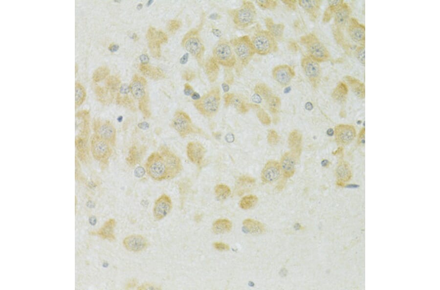 Immunohistochemistry - Anti-SLC37A4 Antibody (A90013) - Antibodies.com