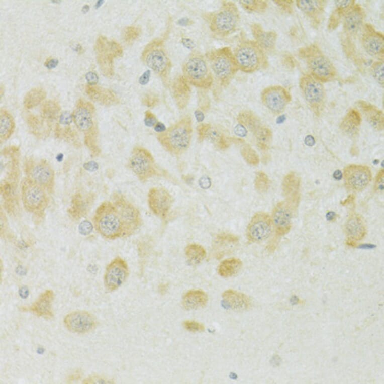Immunohistochemistry - Anti-SLC37A4 Antibody (A90013) - Antibodies.com