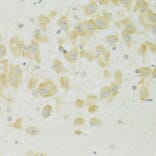 Immunohistochemistry - Anti-SLC37A4 Antibody (A90013) - Antibodies.com