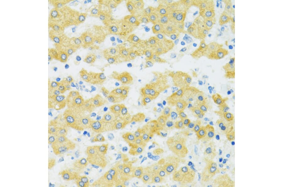 Immunohistochemistry - Anti-SLC37A4 Antibody (A90013) - Antibodies.com