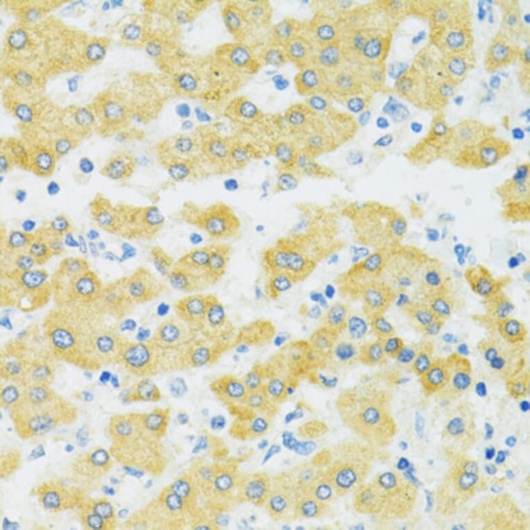 Immunohistochemistry - Anti-SLC37A4 Antibody (A90013) - Antibodies.com
