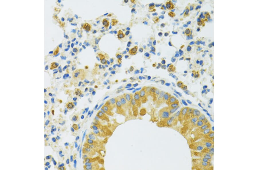 Immunohistochemistry - Anti-SLC37A4 Antibody (A90013) - Antibodies.com