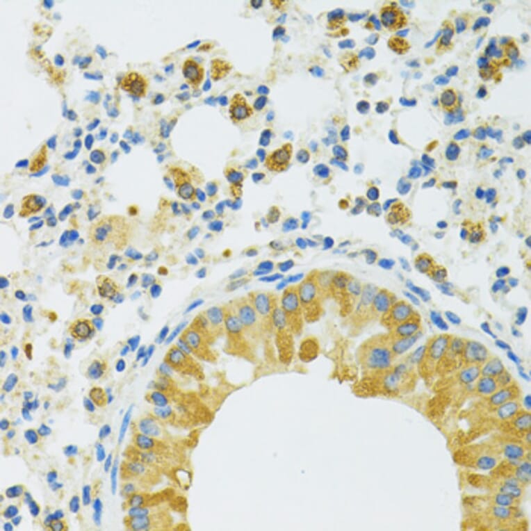 Immunohistochemistry - Anti-SLC37A4 Antibody (A90013) - Antibodies.com
