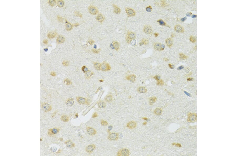 Immunohistochemistry - Anti-SLC37A4 Antibody (A90013) - Antibodies.com
