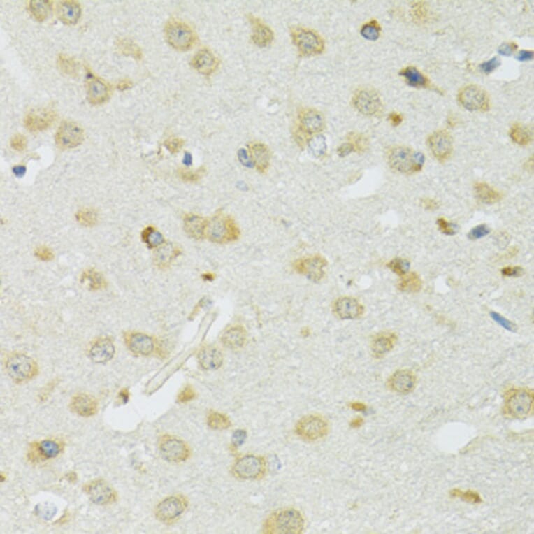 Immunohistochemistry - Anti-SLC37A4 Antibody (A90013) - Antibodies.com