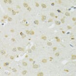Immunohistochemistry - Anti-SLC37A4 Antibody (A90013) - Antibodies.com