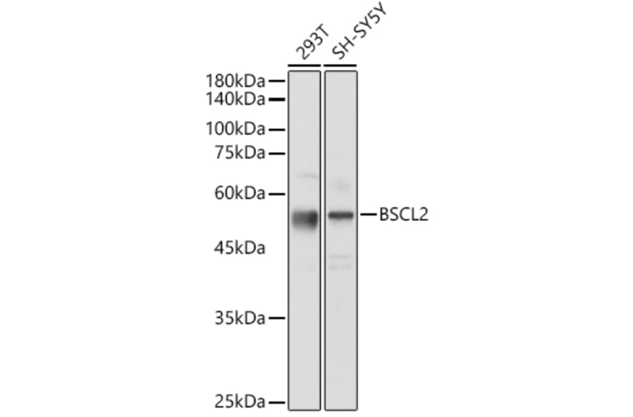 Western Blot - Anti-BSCL2/Seipin Antibody (A90014) - Antibodies.com