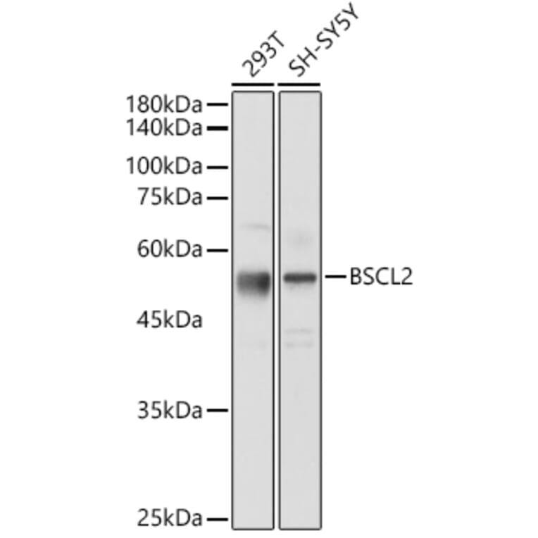 Western Blot - Anti-BSCL2/Seipin Antibody (A90014) - Antibodies.com