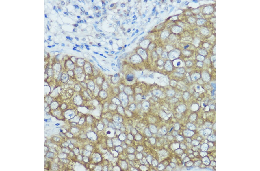 Immunohistochemistry - Anti-BSCL2/Seipin Antibody (A90014) - Antibodies.com