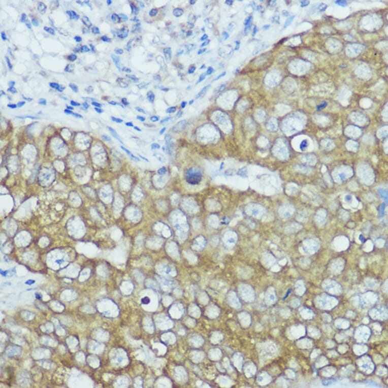 Immunohistochemistry - Anti-BSCL2/Seipin Antibody (A90014) - Antibodies.com