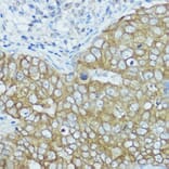 Immunohistochemistry - Anti-BSCL2/Seipin Antibody (A90014) - Antibodies.com