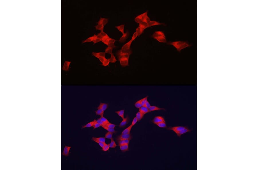 Immunofluorescence - Anti-BSCL2/Seipin Antibody (A90014) - Antibodies.com