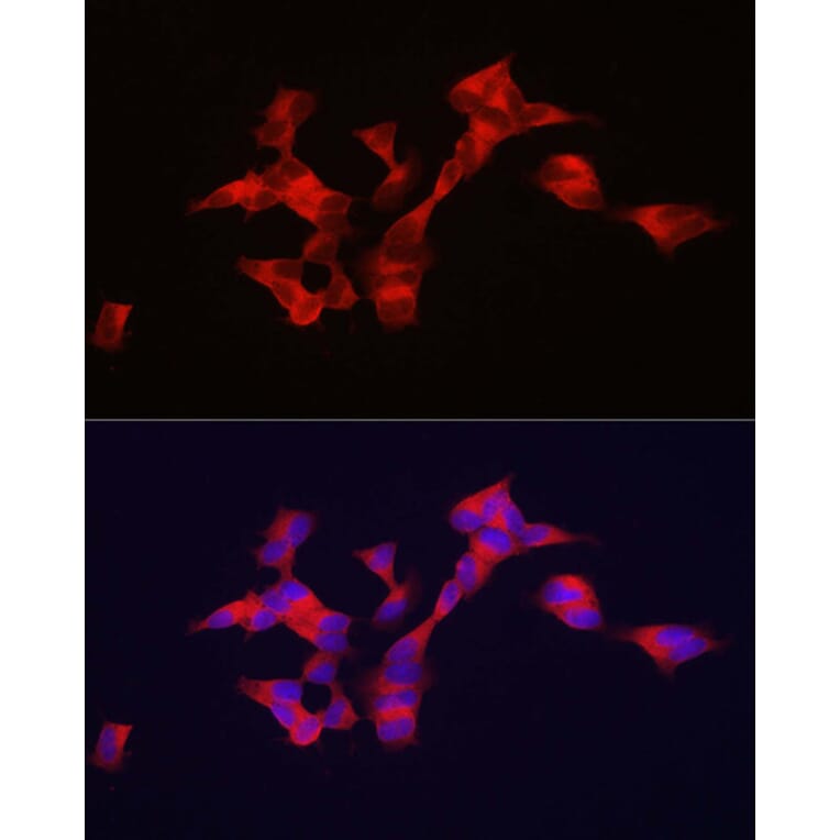 Immunofluorescence - Anti-BSCL2/Seipin Antibody (A90014) - Antibodies.com