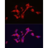Immunofluorescence - Anti-BSCL2/Seipin Antibody (A90014) - Antibodies.com