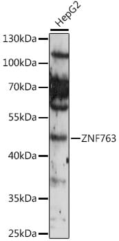 Western blot analysis of extracts of various cell lines, using Anti-ZNF763 Antibody (A16615) at 1:1,000 dilution.
Secondary antibody: Goat Anti-Rabbit IgG (H+L) (HRP) (AS014) at 1:10,000 dilution.
Lysates / proteins: 25µg per lane.
Blocking buffer: 3% non-fat dry milk in TBST.
Detection: ECL Enhanced Kit (RM00021).
Exposure time: 10s.
