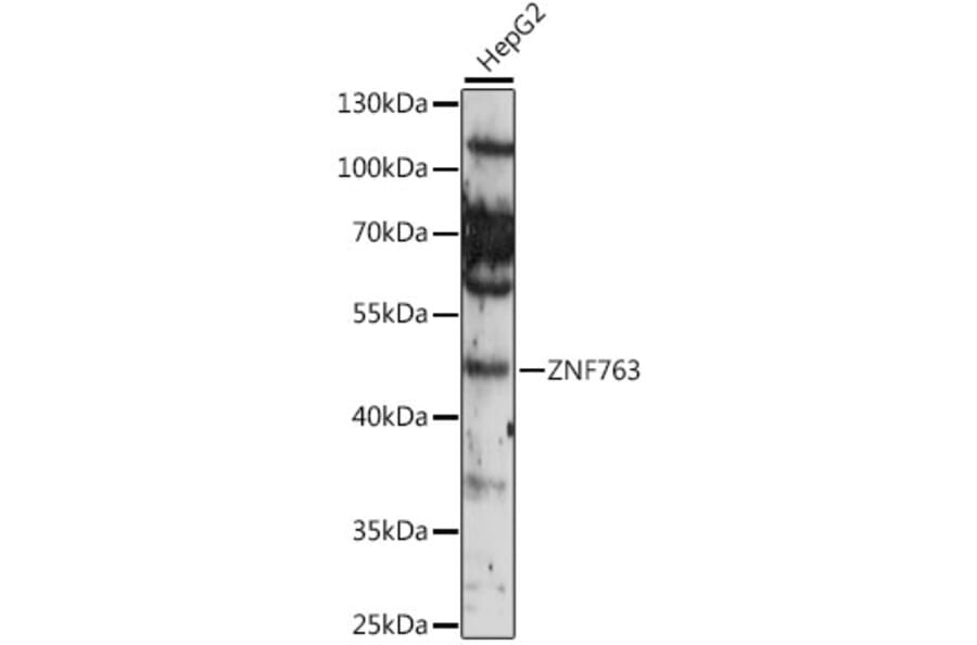 Western Blot - Anti-ZNF763 Antibody (A90015) - Antibodies.com
