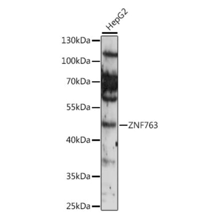 Western Blot - Anti-ZNF763 Antibody (A90015) - Antibodies.com