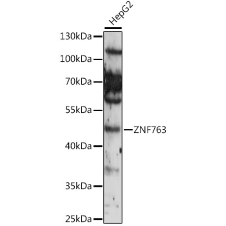 Western Blot - Anti-ZNF763 Antibody (A90015) - Antibodies.com