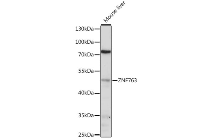 Western Blot - Anti-ZNF763 Antibody (A90015) - Antibodies.com
