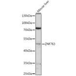 Western Blot - Anti-ZNF763 Antibody (A90015) - Antibodies.com