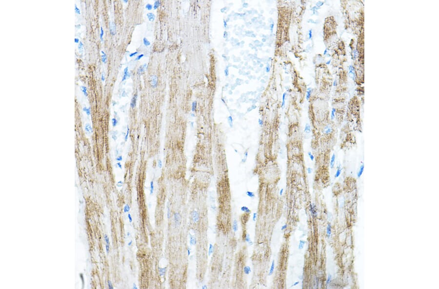 Immunohistochemistry - Anti-PDK4 Antibody (A90016) - Antibodies.com