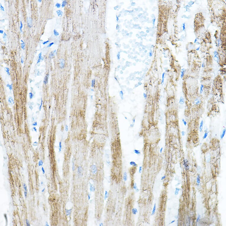 Immunohistochemistry - Anti-PDK4 Antibody (A90016) - Antibodies.com