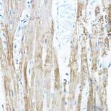 Immunohistochemistry - Anti-PDK4 Antibody (A90016) - Antibodies.com