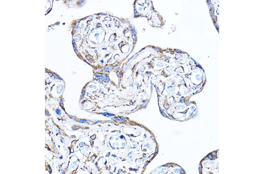 Immunohistochemistry - Anti-PDK4 Antibody (A90016) - Antibodies.com