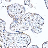 Immunohistochemistry - Anti-PDK4 Antibody (A90016) - Antibodies.com