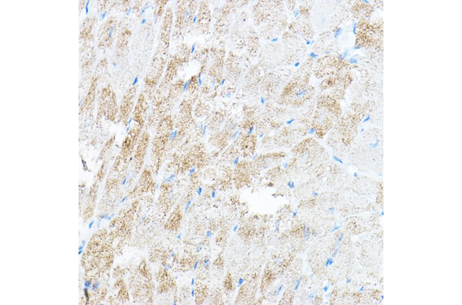 Immunohistochemistry - Anti-PDK4 Antibody (A90016) - Antibodies.com